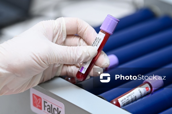 14 Noyabr - Ümumdünya Diabet Günü