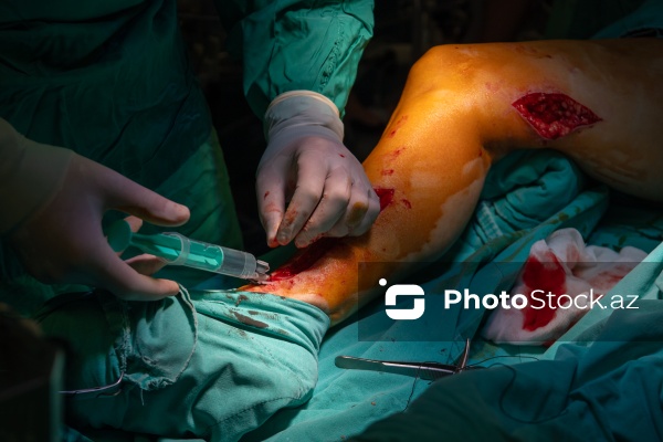 Yeni Klinikada icra edilən ürək əməliyyatı