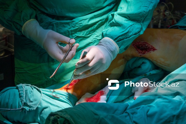 Yeni Klinikada icra edilən ürək əməliyyatı